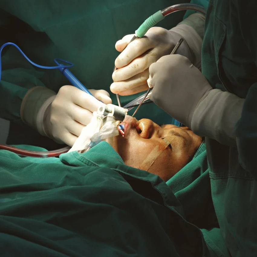 Illustrative surgical procedure